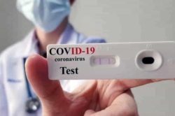 Stato dell’arte e raccomandazioni sui test sierologici per Covid-19