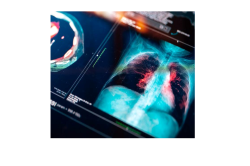 Ultrasonografia nella insufficienza respiratoria acuta, esame fast di grande attualità. Corso ECM a Campobasso